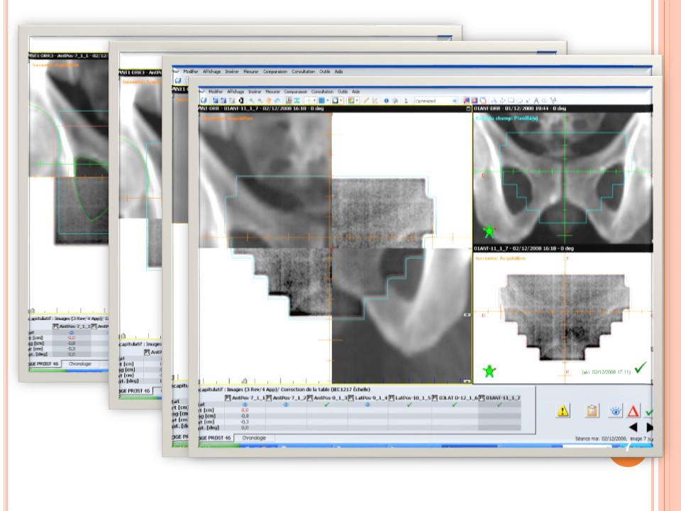 radiotherapie 3d 07